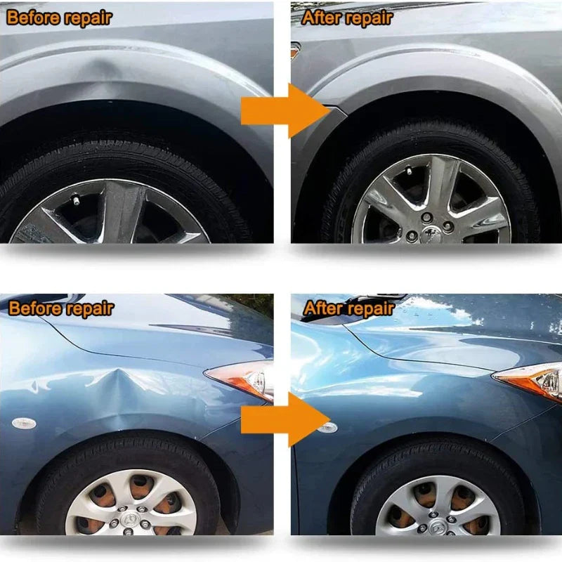 Besper Car Body Paintless Dent Repair Removal Tool
