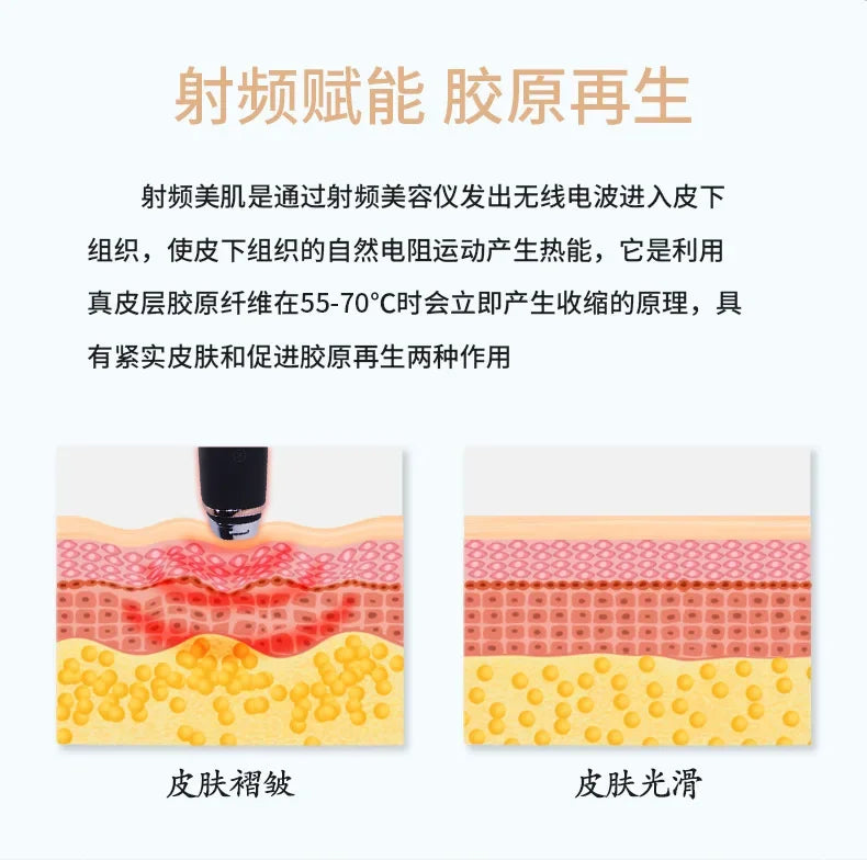 Radio frequency eye beauty instrument eye introduction massage