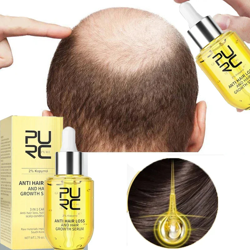 PURC Fast Hair Growth for Men Women Ginger