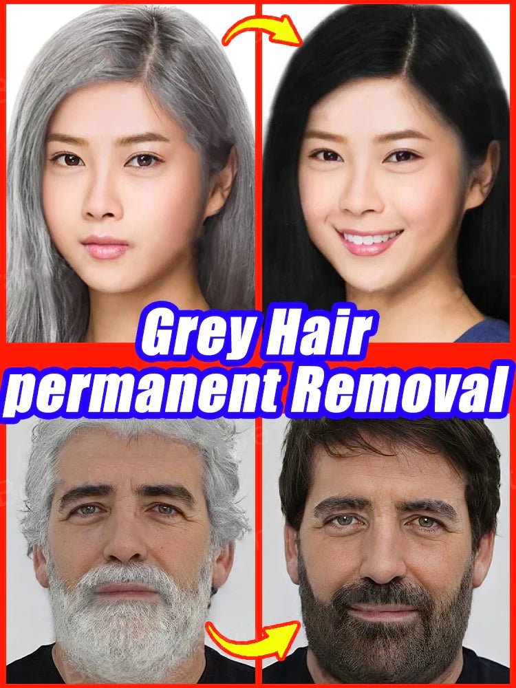 White hair killer, remove gray hair and restore