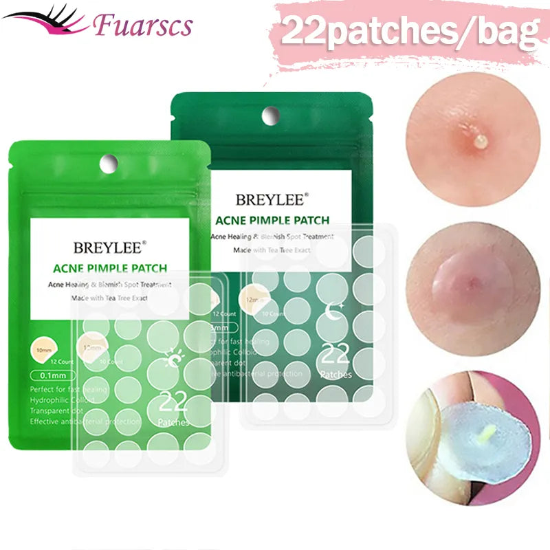 0.1mm Acne Pimple Patch Stickers Waterproof Acne Treatment