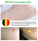 0.1mm Acne Pimple Patch Stickers Waterproof Acne Treatment