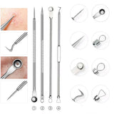 1/4pc Stainless Steel Blackhead Comedone Acne Blemish Extractor