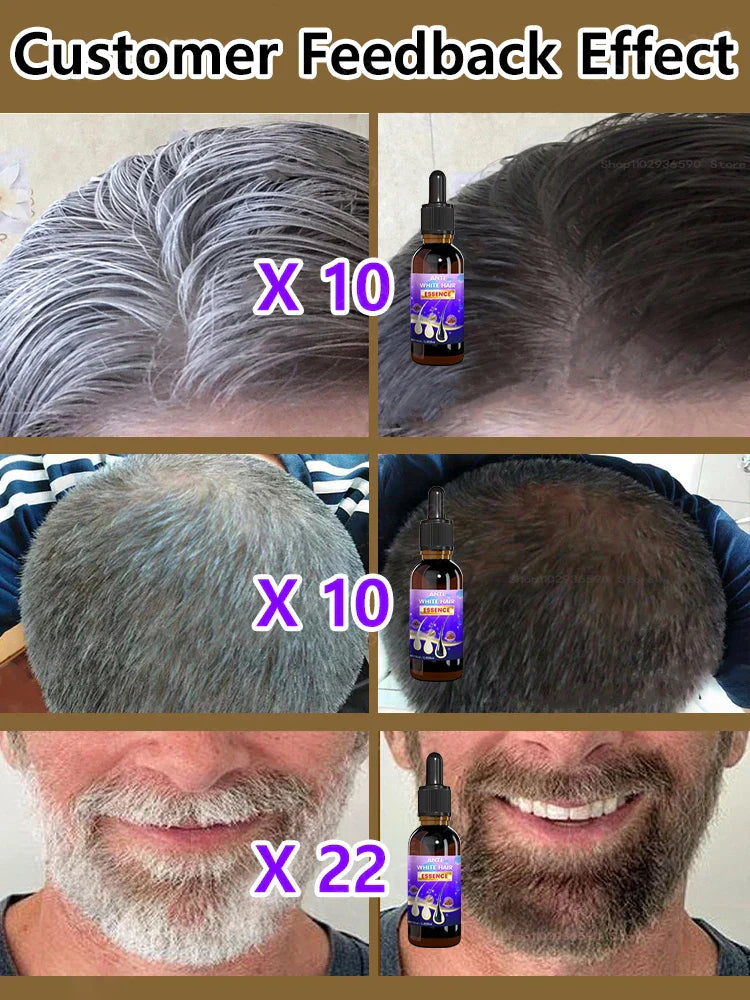 10PCS Gray White Hair Treatment Serum Liquid White