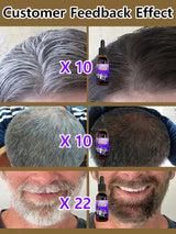10PCS Gray White Hair Treatment Serum Liquid White