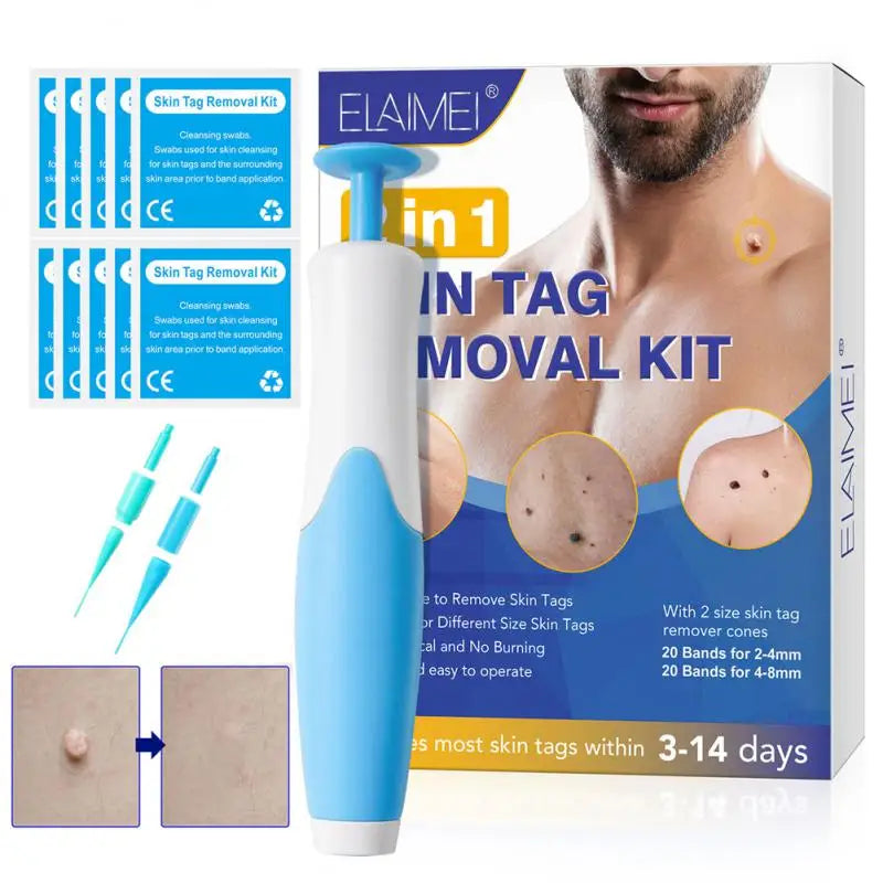 2 In1 Painless Auto Skin Tag Mole Wart
