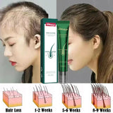 2023 Biotin Fast Hair Growth Oil Hair Regrowth