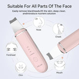 ANLAN Ultrasonic Skin Scrubber Deep Face Cleaning Machine