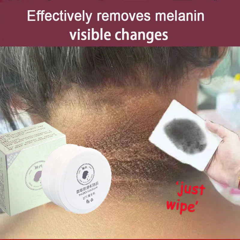 Anti Acanthosis Nigricans Whitening Cream Remove Melanin Armpit