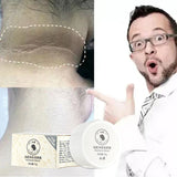 Anti Acanthosis Nigricans Whitening Cream Remove Melanin Armpit