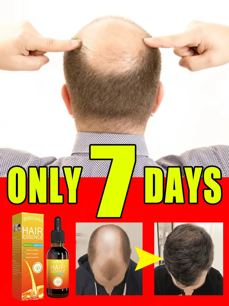 Anti Alopecia Fast Hair Growth Oil Ginger Essential