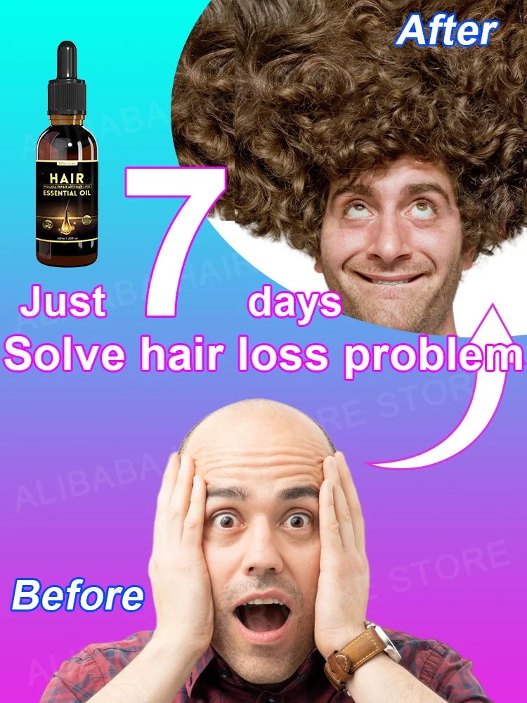 Best-selling Hair Growth Products, Anti-Hair Loss Hair Growth