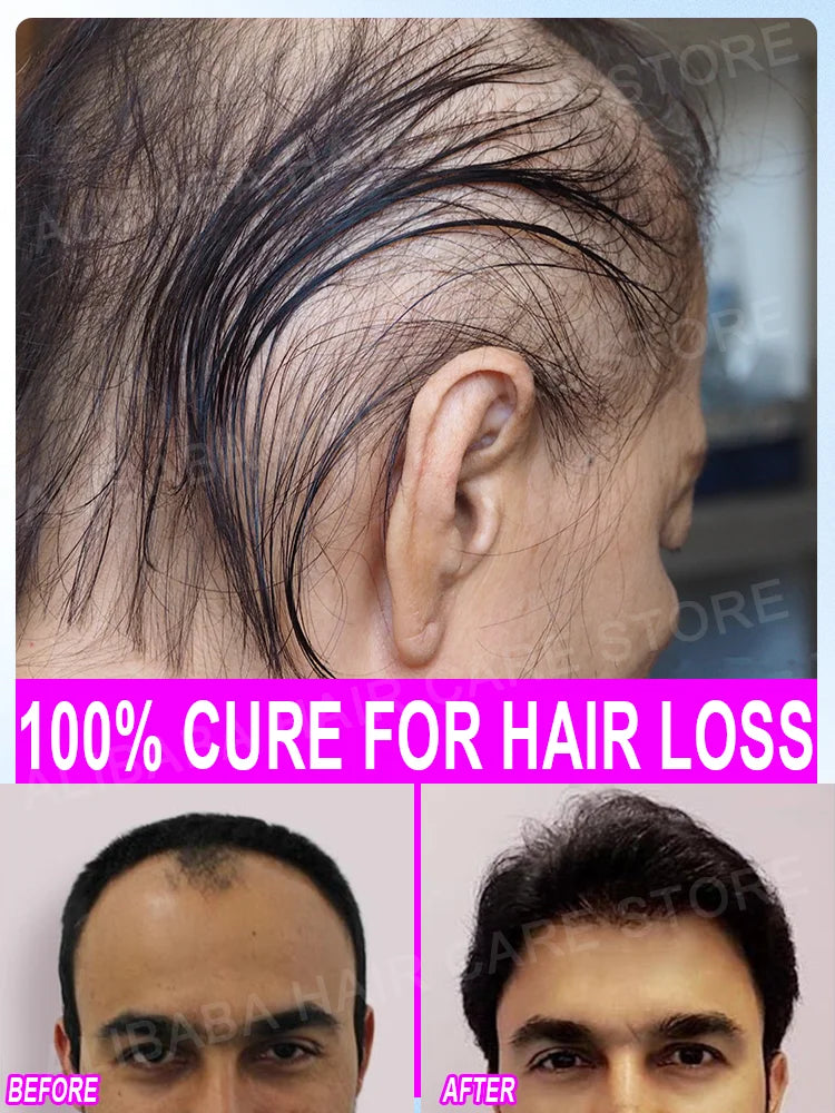 Best-selling Hair Growth Products, Anti-Hair Loss Hair Growth