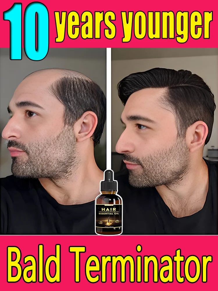 Best-selling Hair Growth Products, Anti-Hair Loss Hair Growth