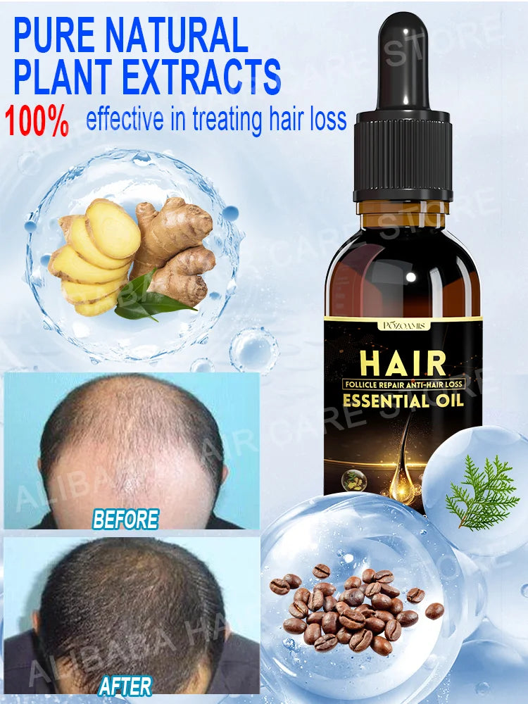 Best-selling Hair Growth Products, Anti-Hair Loss Hair Growth