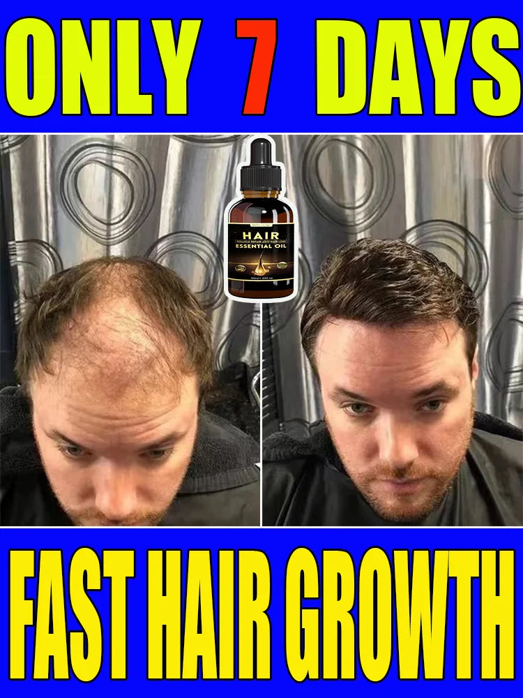 Best-selling Hair Growth Products, Anti-Hair Loss Hair Growth