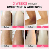 Body Cream Chicken Skin Removal Treatment Keratosis Pilaris