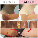 Body Whitening Cream Arms Thighs Underarm Knees Whitening