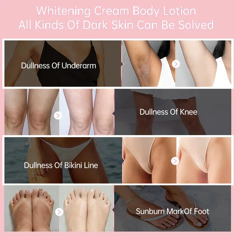 Body Whitening Cream Arms Thighs Underarm Knees Whitening