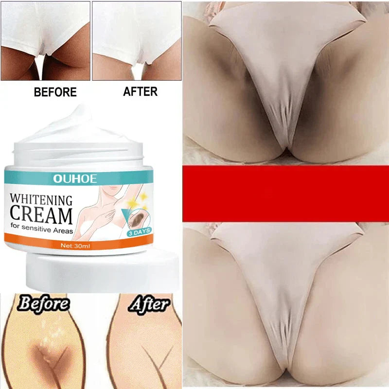 Body Whitening Cream Women Underarm Legs Knee Elbow