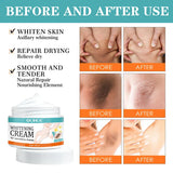 Body Whitening Cream Women Underarm Legs Knee Elbow