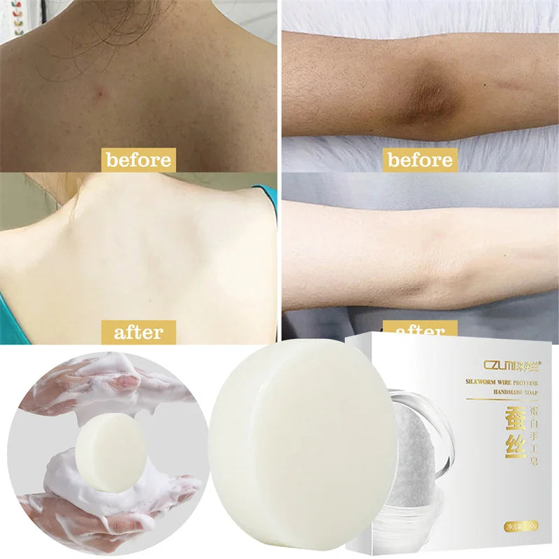 Body Whitening Soap Underarm Knee Bleaching Soap Chicken