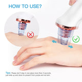 CkeyiN Electric Blackhead Remover Vacuum Facial Acne Cleaner