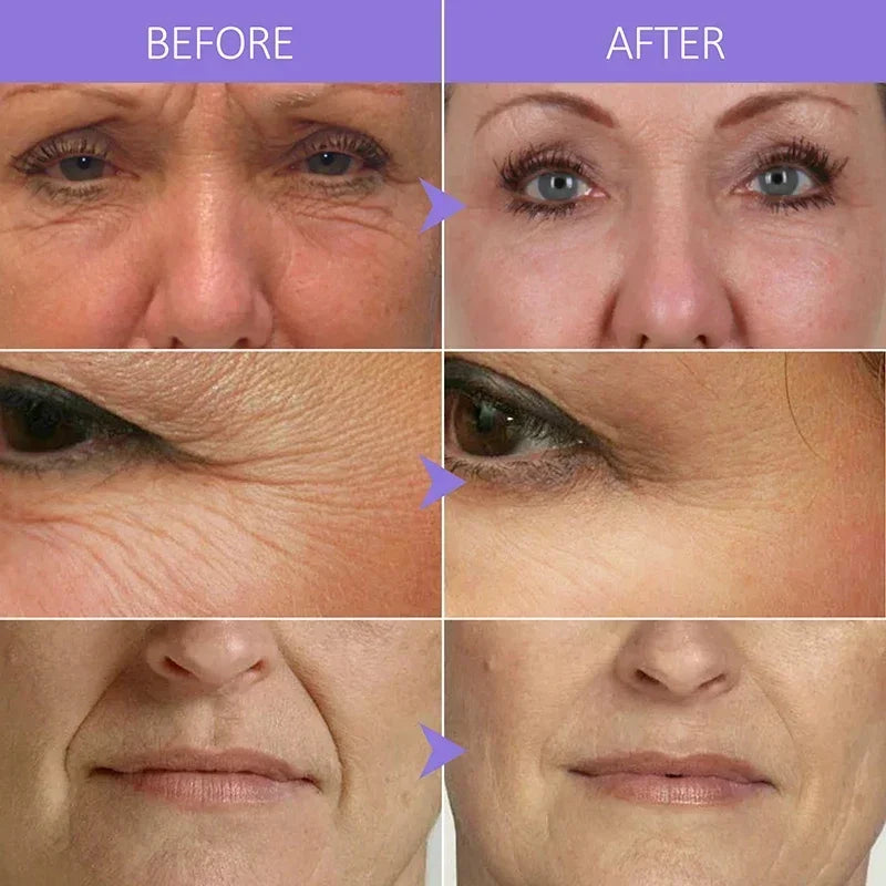 Collagen Face Serum Wrinkle Removal Anti Aging Hyaluronic