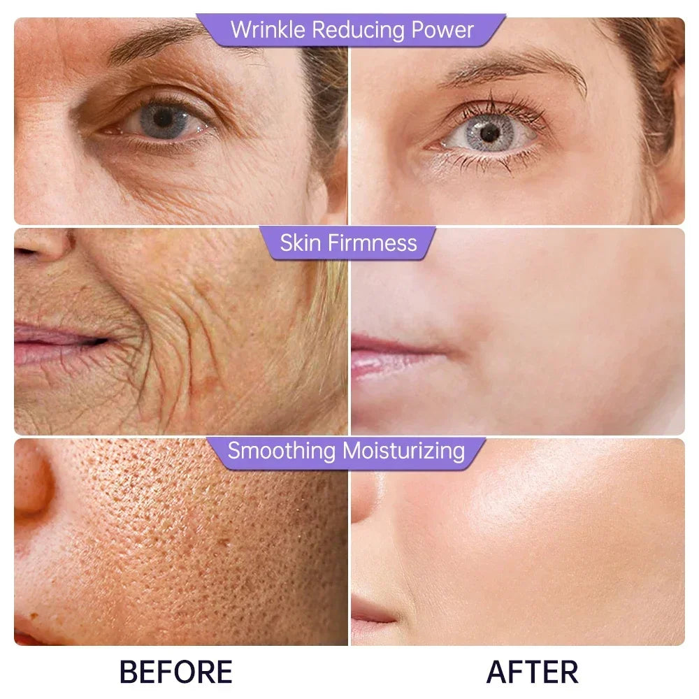 Collagen Face Serum Wrinkle Removal Anti Aging Hyaluronic