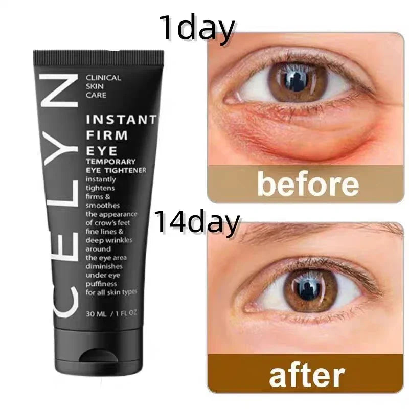 Eyes Cream CËLYN Lifting Firming Eye Skin Hyaluronic Acid Reduce Wrinkles Removal Eye Bag Dark Circles Eye Skin Care Product