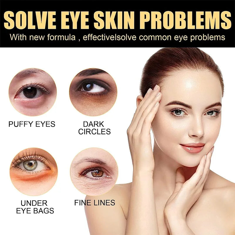 Eyes Cream CËLYN Lifting Firming Eye Skin Hyaluronic Acid Reduce Wrinkles Removal Eye Bag Dark Circles Eye Skin Care Product