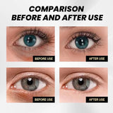 Eyes Cream CËLYN Lifting Firming Eye Skin Hyaluronic Acid Reduce Wrinkles Removal Eye Bag Dark Circles Eye Skin Care Product