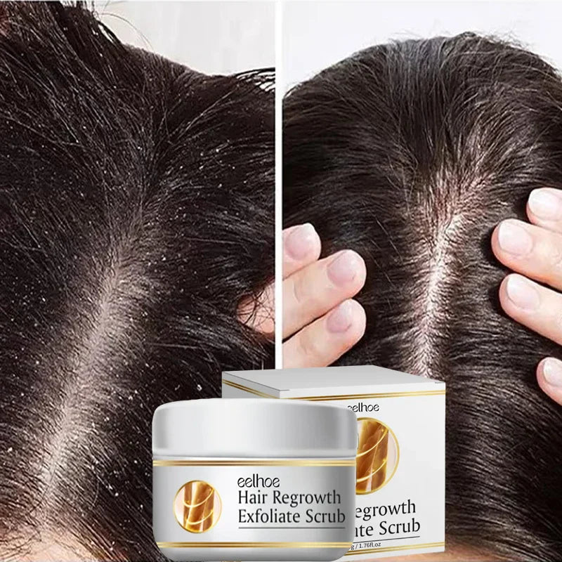 Fast Anti Dandruff Hair Treatment Scrub Itching Repair