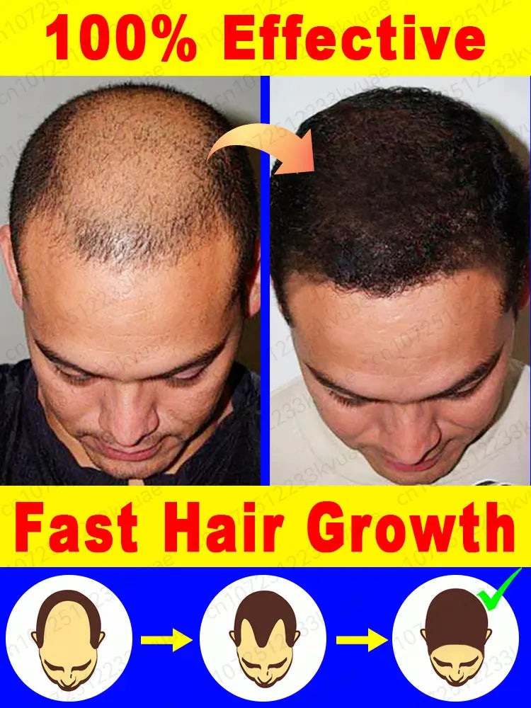 Fast Hair Growth Essence Oil Products Effective Baldness