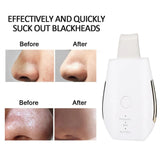 Rechargeable Ultrasonic Face Skin Scrubber Facial Cleaner Peeling