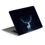 DIY Laptop Sticker Laptop Skin 12/13/14/15/17 inch for