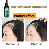 Hair Fast Growth And Care Essential Oil Natural