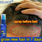 Hair Growth Spray Promote Fast Thicker Longer Ginger