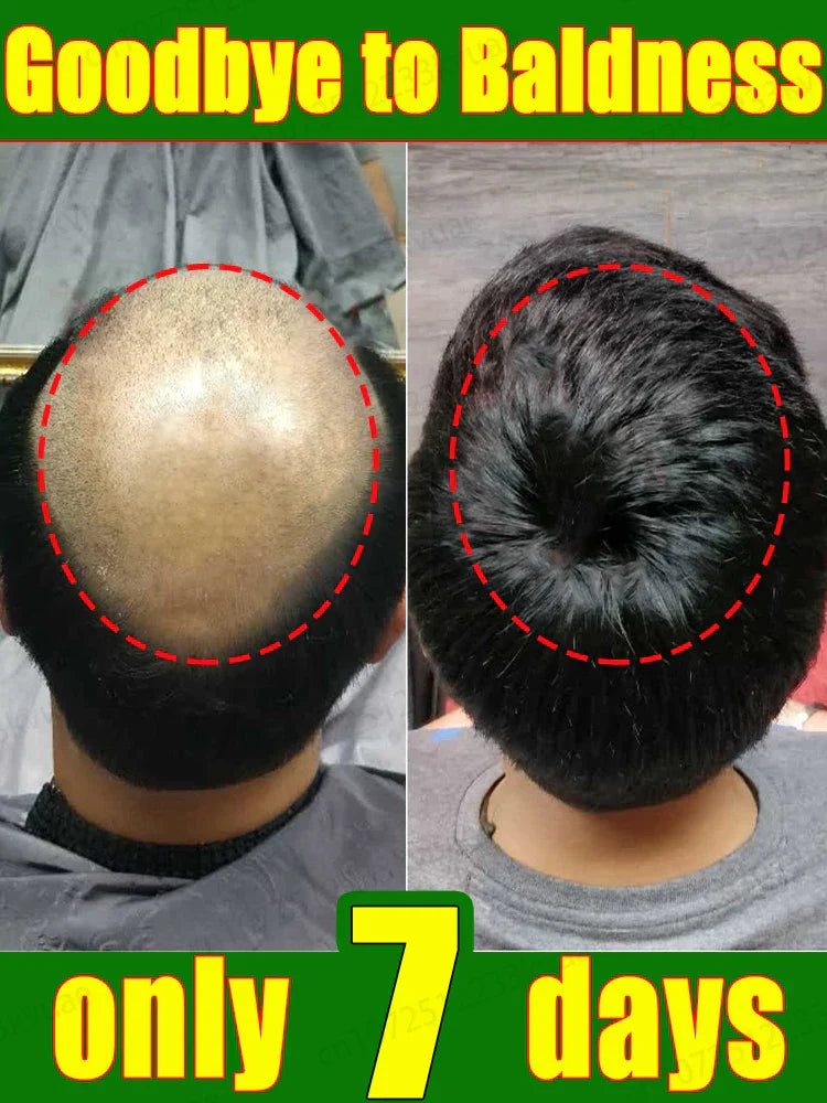 Hair growth essential oil. Effectively repair baldness and