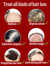 Hair growth essential oil. Effectively repair baldness and