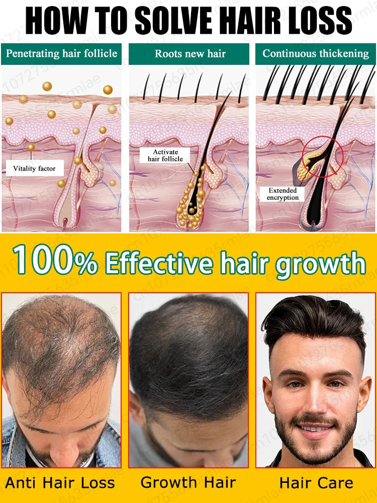 Hair growth essential oil. Effectively repair baldness and