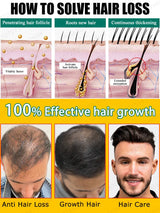 Hair growth essential oil. Effectively repair baldness and