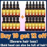 Hair growth essential oil. Effectively repair baldness and