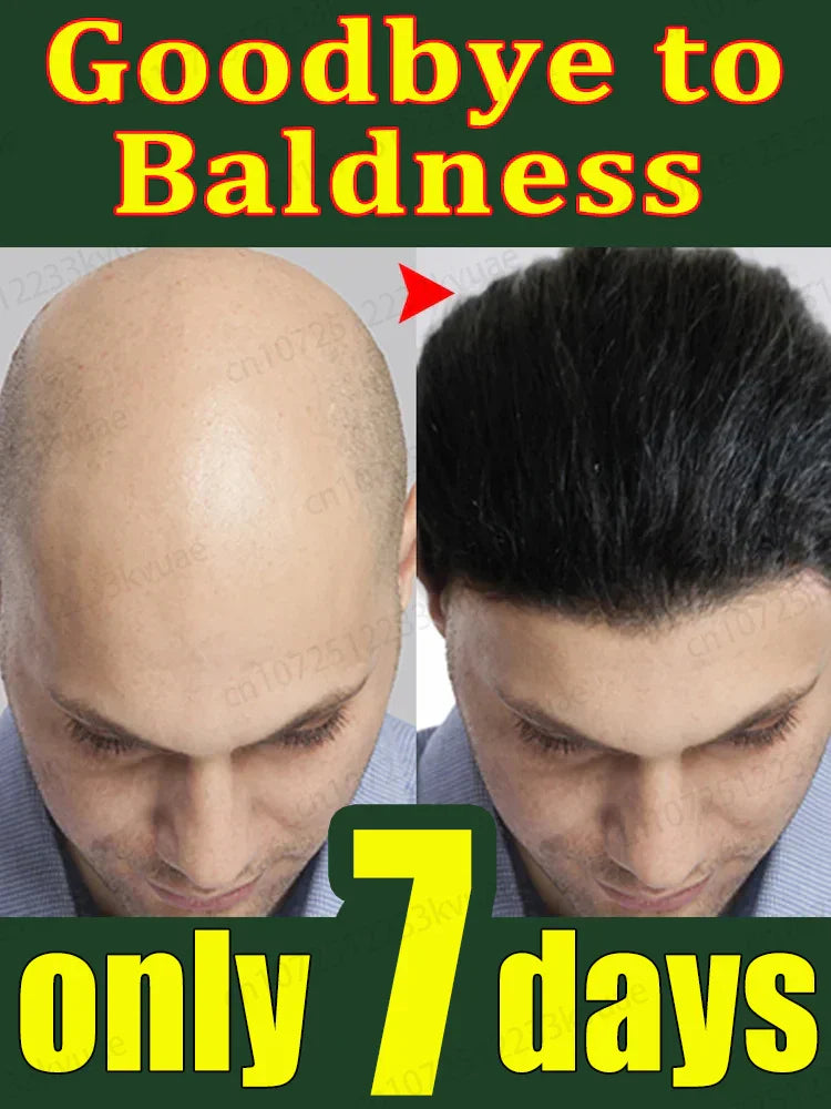 Hair growth oil,effective baldness repair, hereditary hair loss,