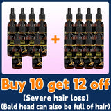 Hair growth oil,effective baldness repair, hereditary hair loss,