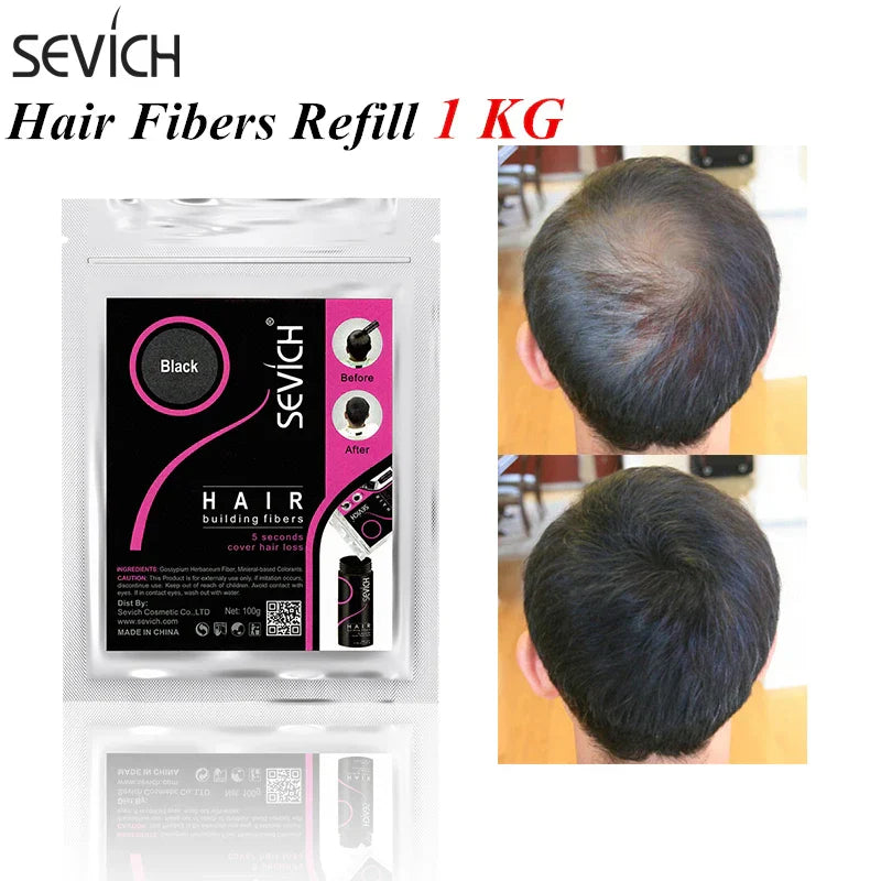 Sevich 1 kg Hair Building Fiber Hair Loss