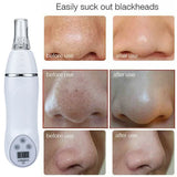 Home Use Blackhead Acne Removal Beauty Device Microdermabrasion