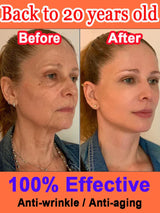 Instant Anti Wrinkle Serum Remove Wrinkle Retinol Lifting