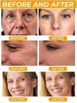 Instant Anti Wrinkle Serum Remove Wrinkle Retinol Lifting