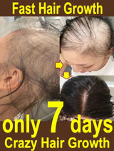 Instant Hair Growth Oil Restorer Bald Patch Repair